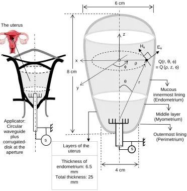 Fig. 3.  Endometrium model toward EM ablation considerations 