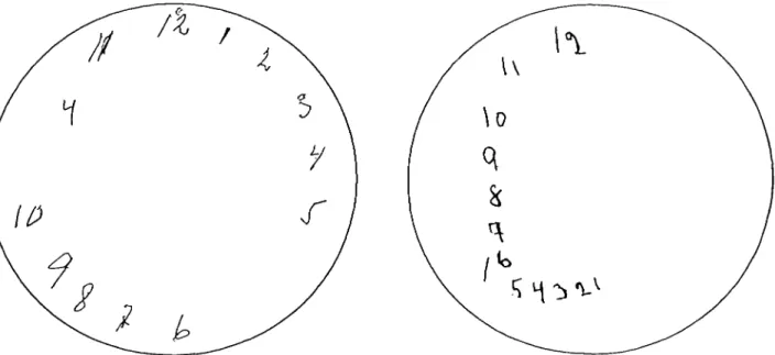 Figure I. A clock-drawing test with a pre-drawn circle 10 cm in diameter performed by in a 76-year-old woman with Alzheimer's disease