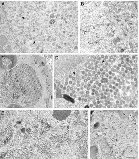 FIG. 8. Ultrastructural analysis of insect cells infected with viruses expressing VP19C TN mutants