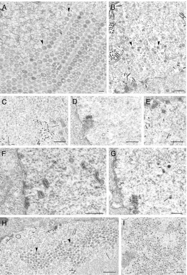FIG. 7. Ultrastructural analysis of insect cells infected with viruses expressing VP23 TN mutants