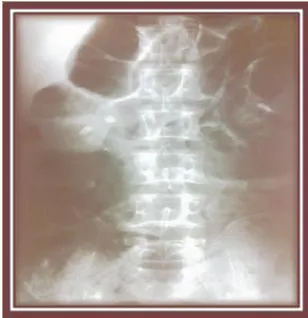 Figure No 10 - Sentinel loop sign