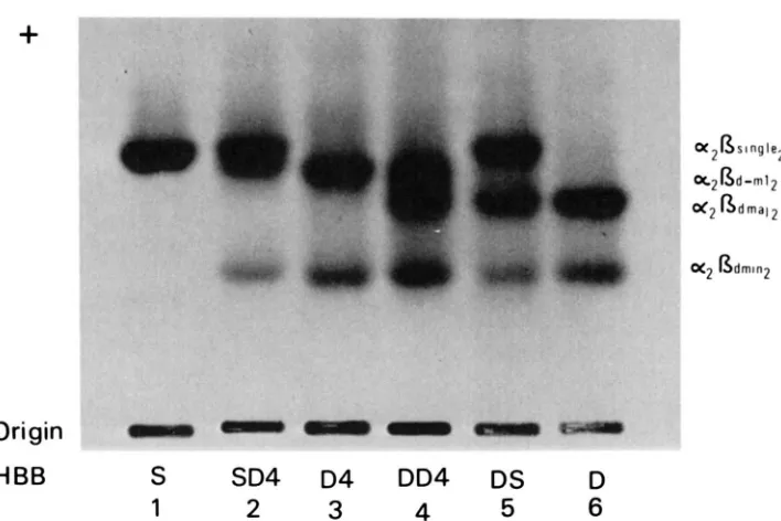 FIGURE I.-Photograph polycythemic stocks after cellulose acetate electrophoresis. T h e  subunit composition of the bands to show HBB in cystamine-treated hemolysates from mice of the is shown on the right