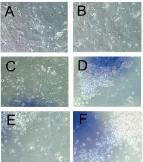 Figure 4.3: HEK growth on the control (A), glue coated well (B), 20.4 µL grafted film (C), and 30.5 µL grafted film (E); partial release and aggregation of cells after 45 minutes on 20.4 µL grafted film (D, and 30.5 µL grafted film (F)