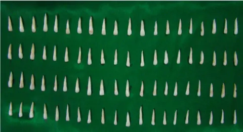 Fig 1.B: Standardization of tooth length to 16mm 
