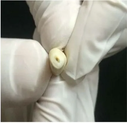 Fig 3.H: Teeth samples with prepared root end cavities 