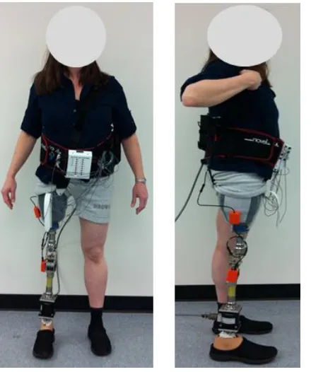 Figure 1.  Experimental setup on one transfemoral amputee subject (TF01). 