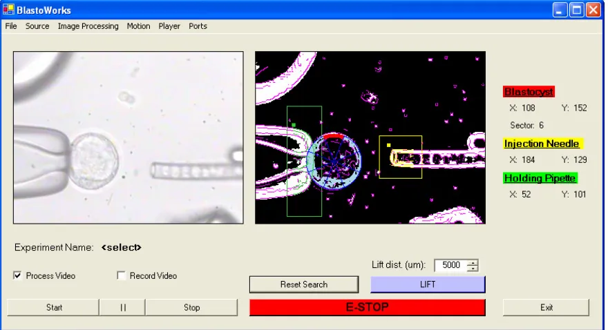 Fig. 2.7.  The interactive user interface used to control the blastocyst micromanipulation and to collect experimental data