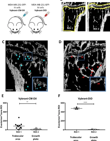 Fig. 2. Homing of the bone-seeking MDA-MB-231-GFP-IV cell-line. (A) Experimental outline of theintravenously (i.v.) with PBS on day 0 followed by 1 × 10 in vivo study