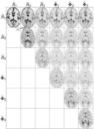 Fig. 15. Aggregate covariance measures evaluated on DTI slice: shape variance