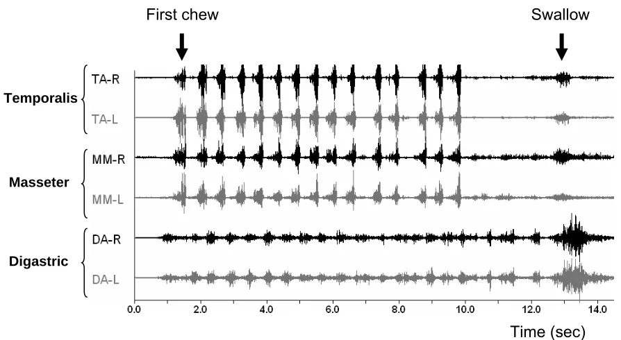 Fig. 8. EMG chewing response starting from the first chew to the swallow.  