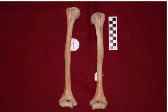 Figure 6.1 Comparison of humeri that are dissimilar in size: 415.3-1082.2 (p=0.041) 