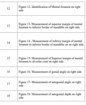 Figure 12- Identification of Mental foramen on right side 