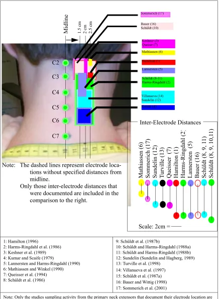 Figure 5: Location of Superior Electrode for Primary Neck Extensors
