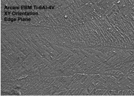 Figure 3.7:  A SEM micrograph showing the morphology and distribution of the � (BCC) phase in a EBM fabricated Ti-6Al-4V alloy