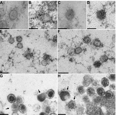 FIG. 5. Immunoelectron microscopy of PrV-Ka-infected cells. RK13 cells were infected with PrV-Ka as described above, and ultrathin sectionswere labeled with anti-UL17 serum (A to G) or anti-UL48 serum (H)