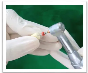 Fig 6 c: Tooth preparation 
