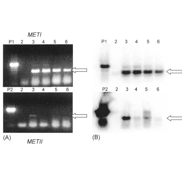 Figure 3.6 (A), RT-PCR of METIi transgenic lines separated on 2% agarose gel. Upper 