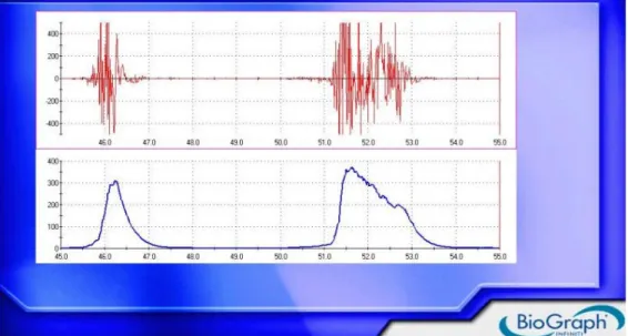 Fig. 2. Raw EMG in red (top) and equivalent RMS EMG in blue (bottom) 
