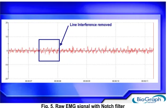 Fig. 5. Raw EMG signal with Notch filter 