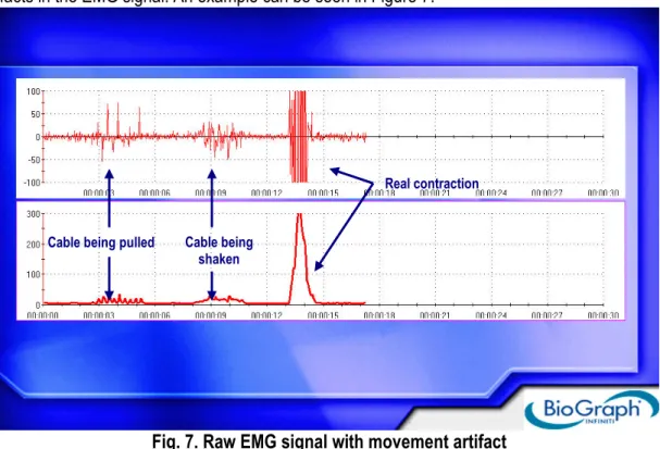 Fig. 7. Raw EMG signal with movement artifact 