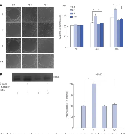 Fig. 6. Inhibitory effects of rutin on glucose fluctuation-induced vascular smooth muscle cell migration in Otsuka Long-Evans Tokushima Fatty rats
