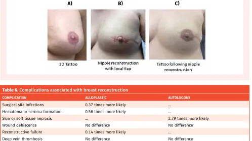 Table 6. Complications associated with breast reconstruction