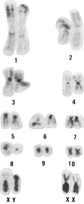 FIGURE 1 the .-Chromosome complement of a male Chinese hamster bone marrow cell exhihiting C band; two X chromosomes are inserted from a female peritonium cell