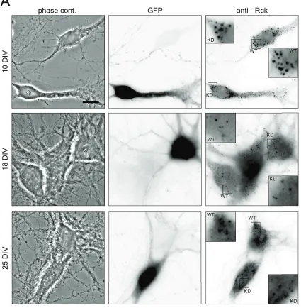 Figure 3.4: Knock-down of Stau2 does not affect the assembly of Rck granules. (A) Representative examples of phase contrast, GFP fluorescence (labeling Stau2-knock-down cells) and Rck immunostaining of 10 DIV, 18 DIV and 25 DIV hippocampal neurons in mixed