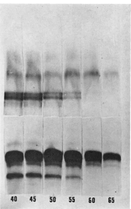 FIGURE 3.Effect from the scutellum Bottom-extract of pollen from the inbred line of temperature on the stability of the acid phosphatase isozymes of maize