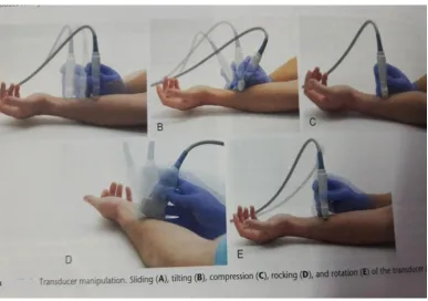 Figure-5. Ultrasound probe manipulation. 