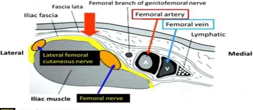 Figure 13.-Fascia iliaca compartment 