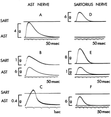 Fig. 12. Records of isometric twitch (A, B, D, E & F) and slow-graded tetanic (C) contractions, in the operated sartorius (SART) and AST muscles, of motor units isolated from the proximal stump of the AST nerve (A-C) of a toad 151 days after the operation 