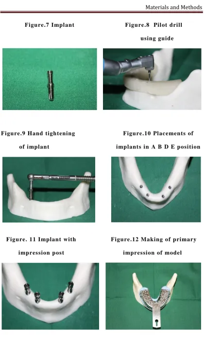 Figure.12 Making of primary 