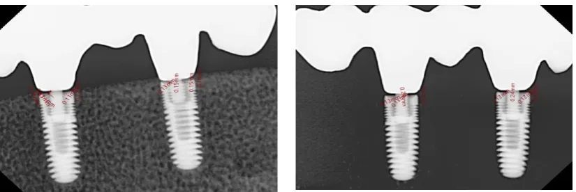 Figure. 41 RVG image with      