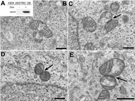 FIG. 2. Expression of capsid induces the formation of electron-dense zones between mitochondria