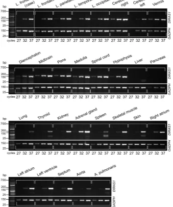 Fig. S4. DIRAS1 expression pattern. Expression profiling of the DIRAS1 transcript 