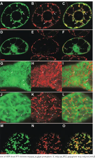 FIG. 2. Expression of GFP-fused P75 deletion mutants in plant protoplasts. N. tabacumand the in vitro transcripts derived from constructs pB2-RT-GFP1 (panels A to C), pB2-RT-I), pRep-MTS-GFP (panels J to L), and pRep-MTS-IS-TM1-GFP (panels M to O)