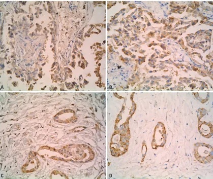 Table 4. The Association between the Expression of P-gp or LRP and Mutations in KRAS in NSCLC