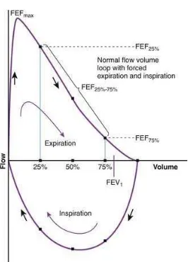 Figure 2: Expiratory flow volume curve [Adapted from Altalag A, Road J, Wilcox P. Pulmonary function tests in clinical practice