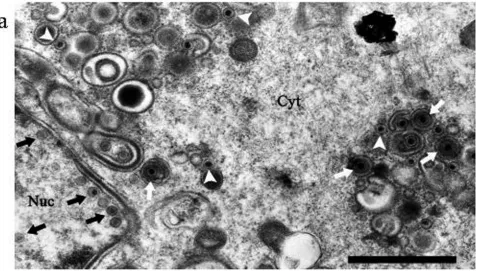FIG. 4. (a) Electron micrograph of CHO cells 24 h after infection with 5 PFU/cell HSV1716gfp/BHK