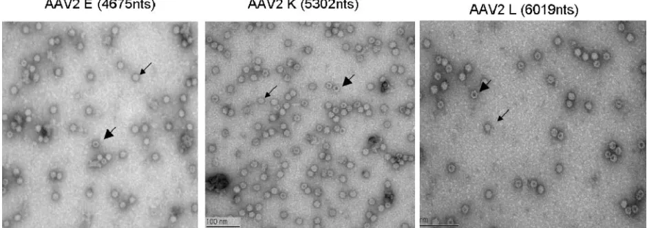 FIG. 4. Transmission electron micrographs of AAV2 E, K, and L preparations. Peak fractions of the FPLC heparin column-puriﬁed AAV2encapsidating the E, K, and L genomes were stained in 2% uranyl acetate and imaged by transmission electron microscopy