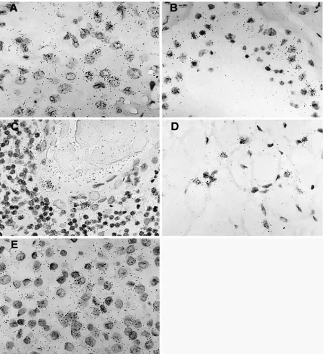 FIG. 5. Hybridization signal obtained with the ERV3 antisense SU probe in ﬁve different tissues