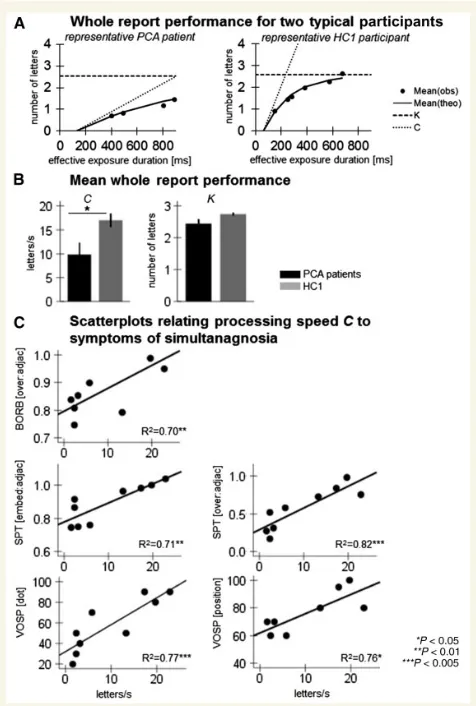 Figure 2 Visual processing speed is slowed in PCA andpredicts simultanagnosia symptoms