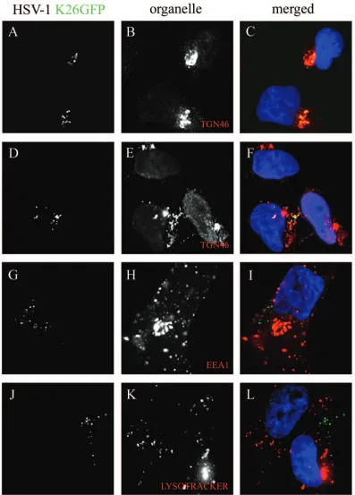 FIG. 5. Colocalization of capsids with the TGN. 143B cells were infected with wild-type K26GFP virus (in green), incubated for 7 h at 37°C,and chased at 20°C for 6 h