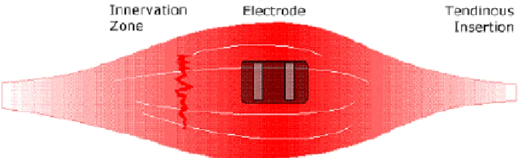 Figure 4:  The preferred electrode location is between the motor point (or innervation zone) and the tendinous  insertion, with the detection surfaces arranged so that they intersect as many muscle fibers as possible.