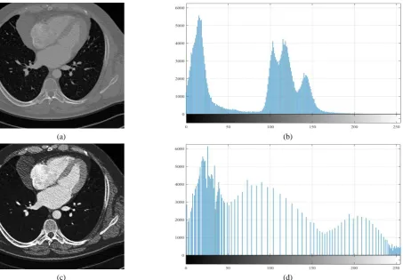 Figure 2. Image enhancement using the bimodal Gaussian function: source image (a) and its histogram (b), enhanced image (c) and its histogram (d) 