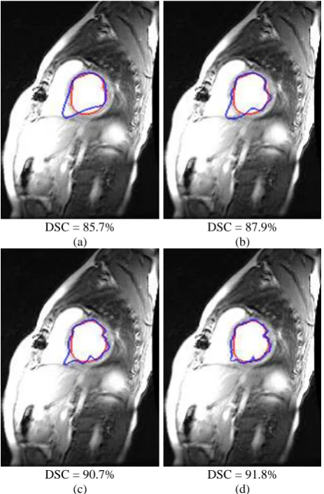 Figure 15. Processing time of the brain tumour segmentation (in  milliseconds) of the proposed algorithm for different ∆� 