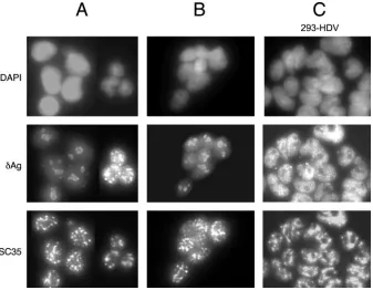FIG. 2. Accumulation of replicating HDV genomic RNA in the 293-�HDV genome replication, cells were transfected with a linear antigenomic HDV RNA that was greater than unit length and contained a2-nucleotide deletion to disrupt the open reading frame for(ﬁl