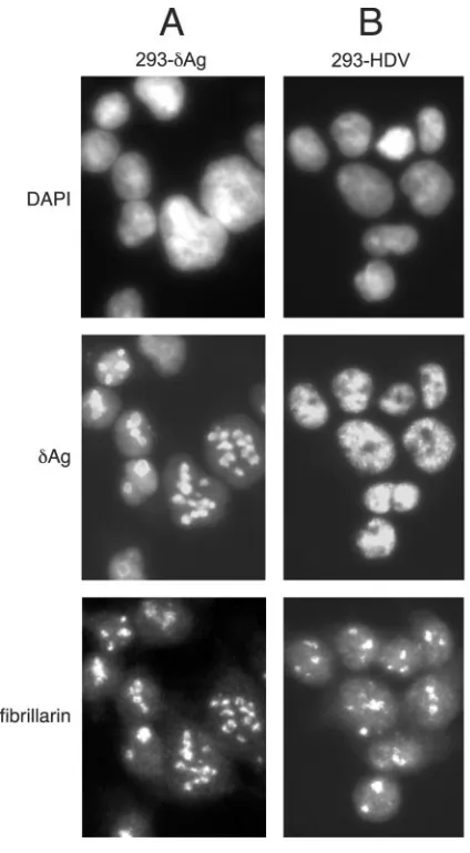 FIG. 4. Immunocytochemistry of 293-�three rows show staining with DAPI, detection ofof ﬁbrillarin