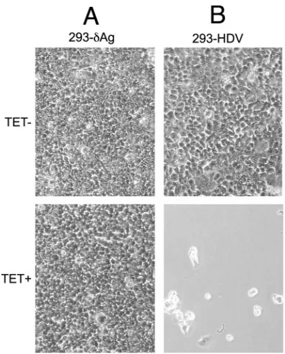 FIG. 7. Cell cycle analyses of 293-�sorting. This allowed separation of cells by DNA content as GAg and 293-HDV cells